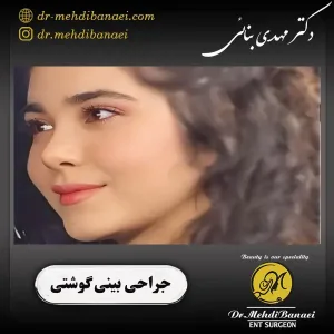 جراحی بینی گوشتی _ دکتر مهدی بنائی