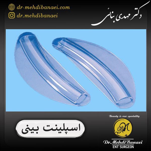 اسپلینت بینی _ دکتر مهدی بنائی