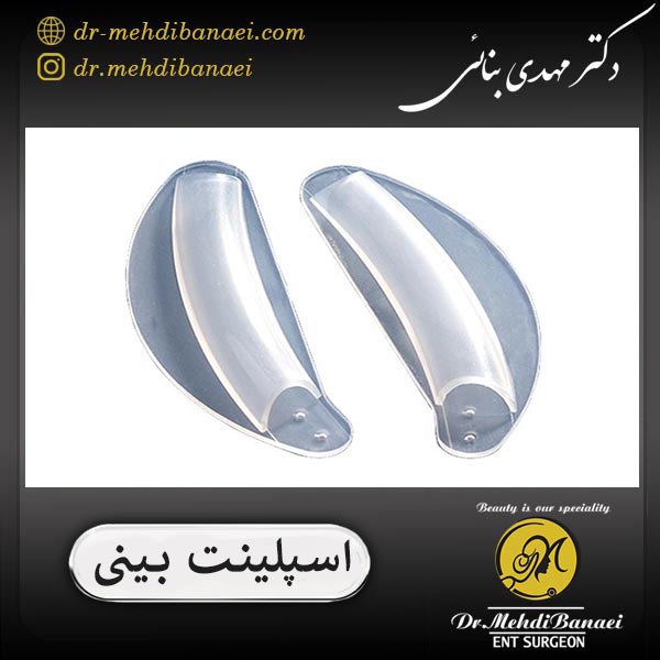 اسپلینت بینی _ دکتر مهدی بنائی