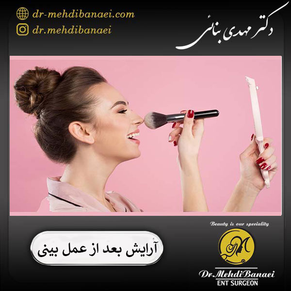 آرایش کردن بعد از عمل بینی _ دکتر مهدی بنائی