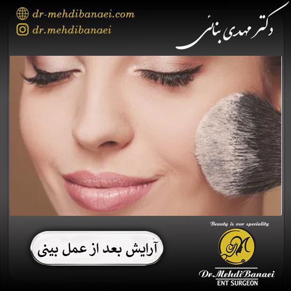 آرایش کردن بعد از عمل بینی _ دکتر مهدی بنائی