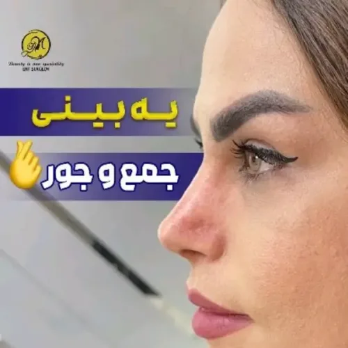 جراحی-بینی-235