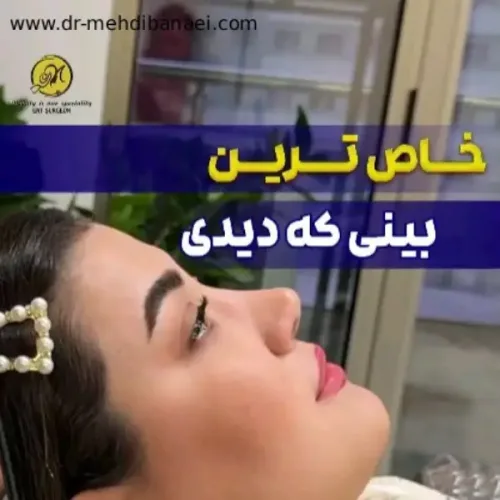 جراحی-بینی-239