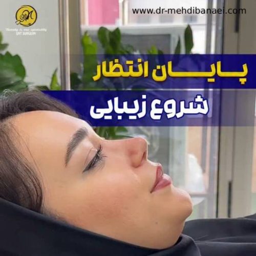 جراحی-بینی-240